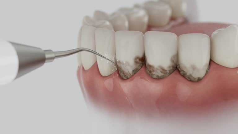 Trusted Wisdom Tooth Removal service in Gosnell, AR - Dentist Open Now